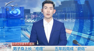 男子身上长“疙瘩”五年后竟成“蘑菇”