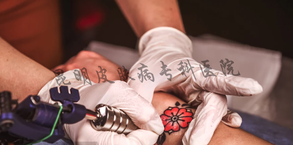 洗纹身留下的疤痕去哪里能祛除 治疗纹身的疤痕去哪里