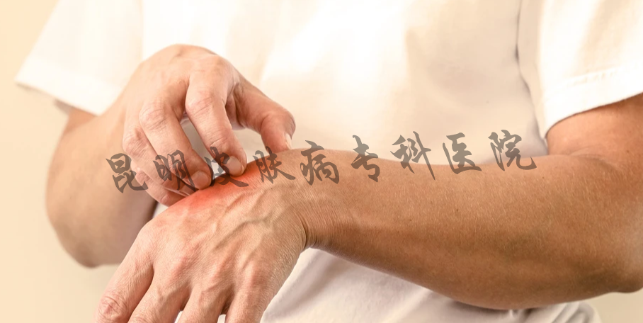 云南省疤痕专家排名 疤痕病昆明治疗专科
