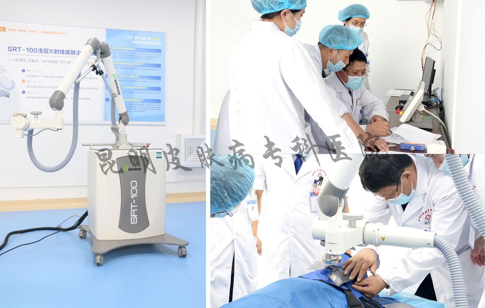 疤痕病专科治疗正规昆明 昆明省疤痕病医院