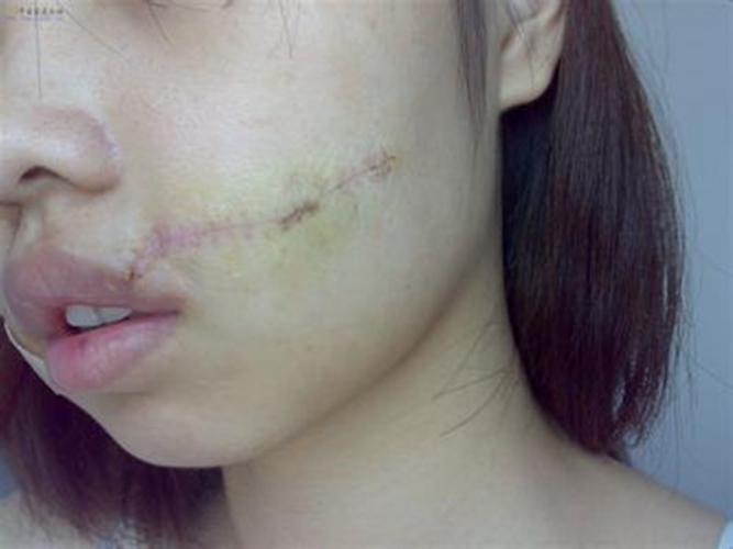 1627616275879388.jpg src=http _file.youlai.cn_cnkfile1_M00_02_17_oYYBAFiEiqKAe-1WAAH4A2UDNyY86.jpeg&refer=http _file.youlai.cn&app=2002&size=f9999,10000&q=a80&n=0&g=0n&fmt=jpeg.jpg