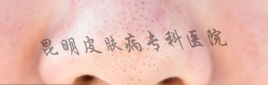 1630476922385230.png 黑头粉刺.png