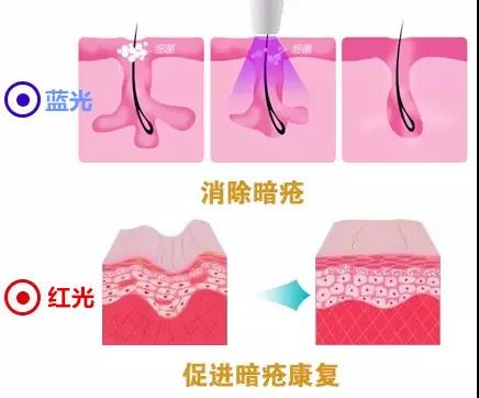 昆明疤痕病医院治疗医院 昆明医院哪家疤痕最好
