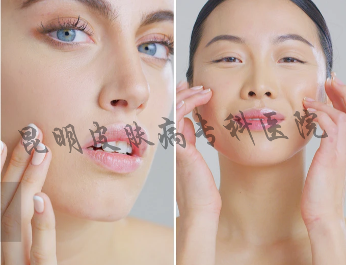 云南治疗痘坑最好的医院 昆明疤痕皮肤病医院